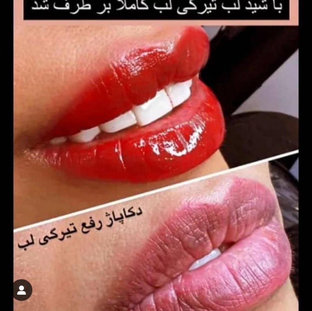 شیدینگ لب